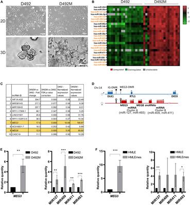 Expression of ncRNAs on the DLK1-DIO3 Locus Is Associated With Basal and Mesenchymal Phenotype in Breast Epithelial Progenitor Cells